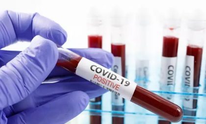 Coronavirus, 429 nuovi casi, età media 39 anni. Tre decessi